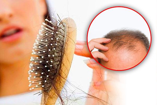 Tips to Stop Hair Fall