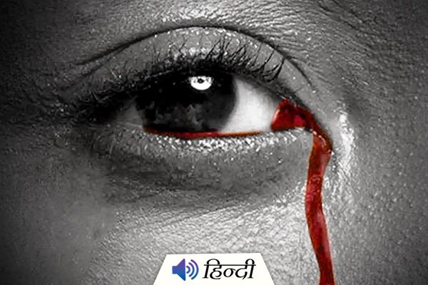 Woman Bleeds Through Her Eyes Every Month