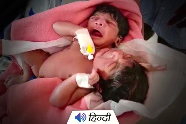Twins Born With 2 Heads & 1 Arm in Odisha