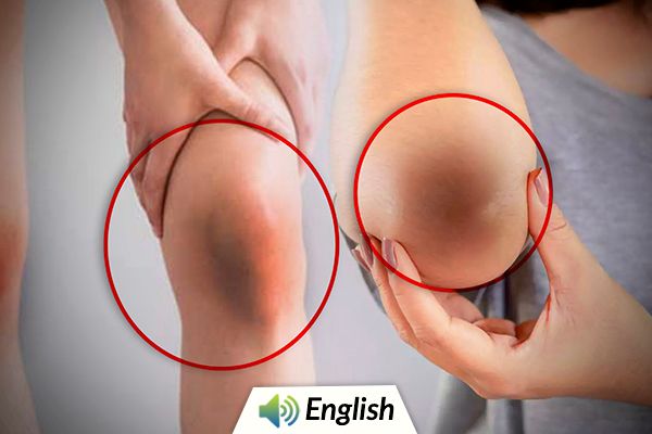 Natural Ways to get Rid of Dark Knees & Elbows