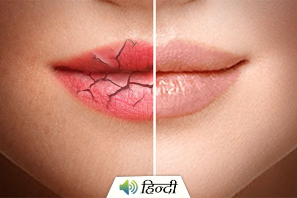 How to Take Care of Dry Lips During Winters?