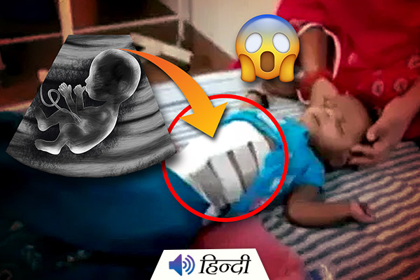 Baby Grows Inside Stomach Of A 40 Days Old Child