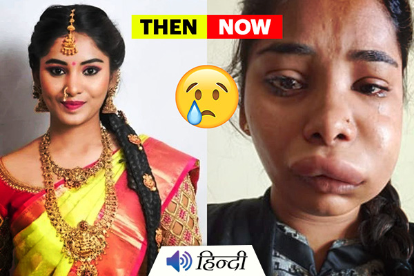 Kannada Actress Swathi Sathish’s Root Canal Surgery Went Wrong