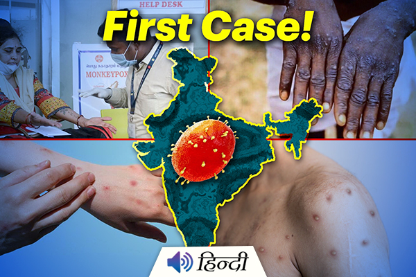 India's First Monkeypox Case Found In Kerala