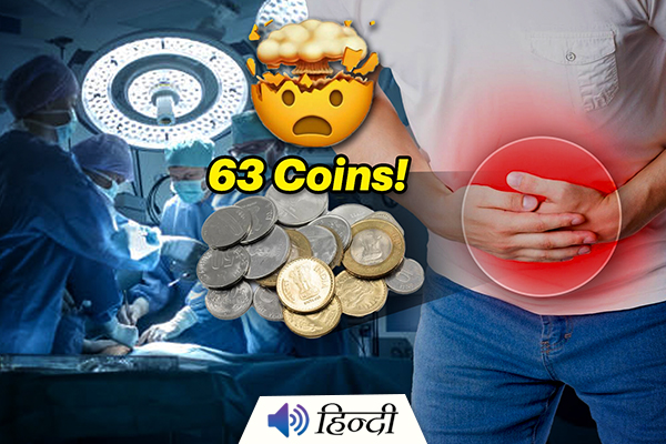 Doctors Took Out 63 Coins From the Stomach of a Man