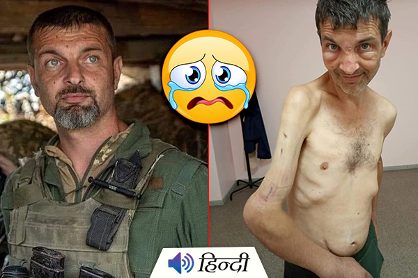 Picture of Ukrainian Soldier After Russian Custody Shocks Everyone