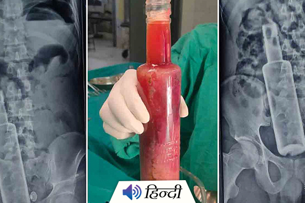 Doctors Remove Vodka Bottle From Man's Stomach In Nepal