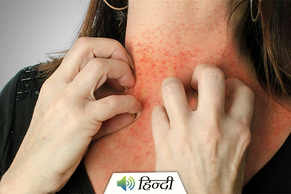How To Treat Skin Rashes with Home Remedies