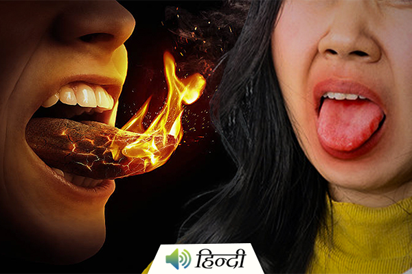 Tips to Treat a Burnt Tongue