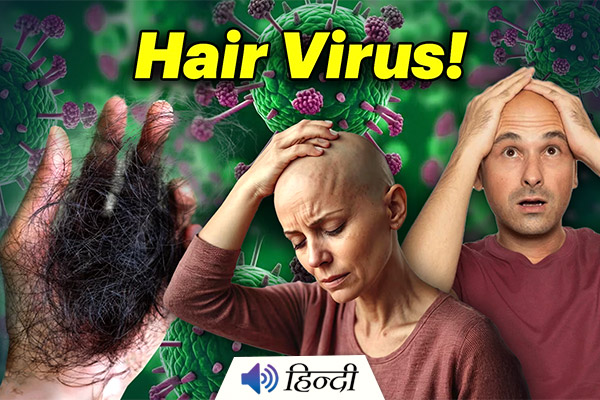 'Bald Virus’ Hits Maharashtra’s Buldhana, Over 150 Lose Hair