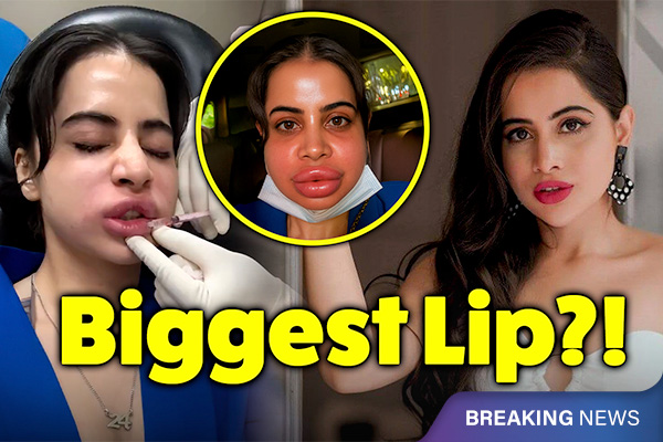 Urfi Javed Removes Her Lip Fillers