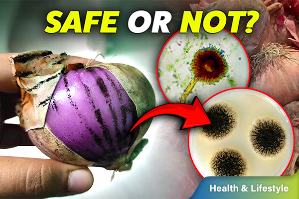 Onions With Black Spots: Safe or Not?